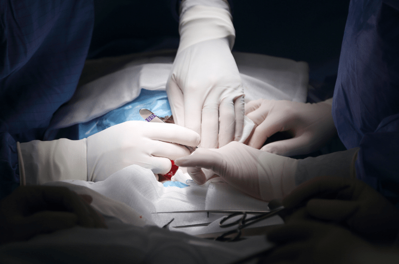 two surgeons' hands and incision